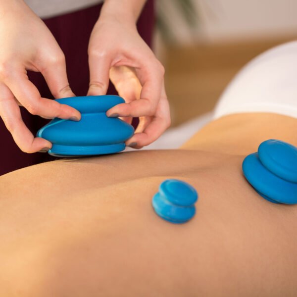 Blue silicone cups being placed on the back